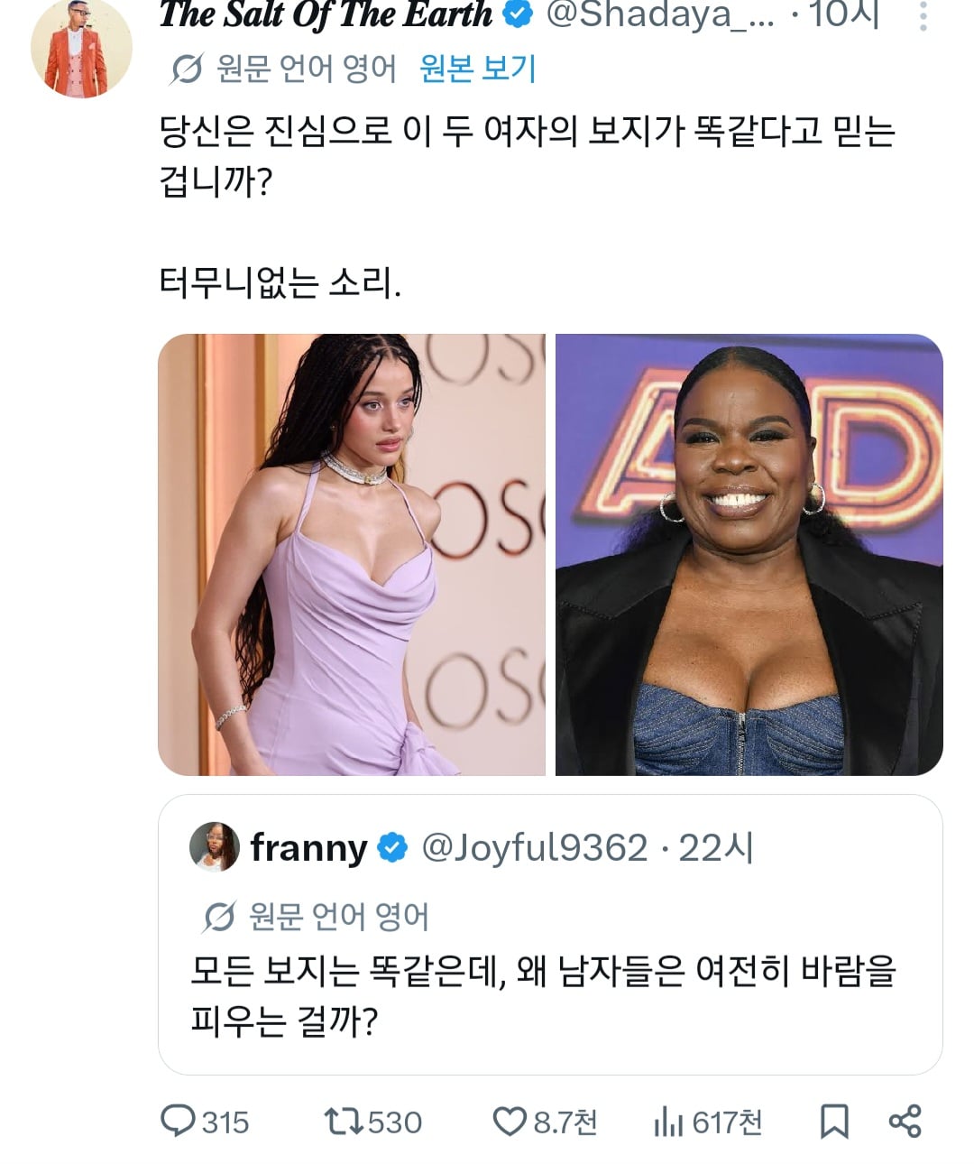여자의 보지는 다른게 맞다.